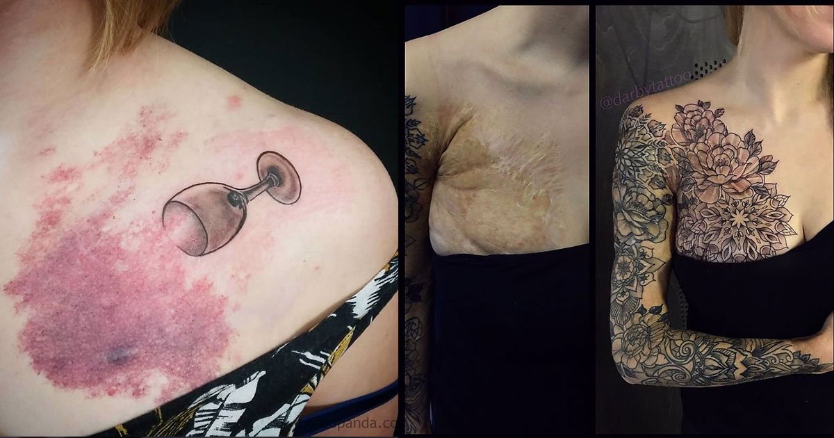 [Zone 42]  65 tatouages ​​originaux pour brûlures, cicatrices et anniversaires